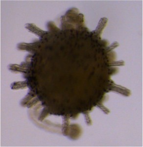 Sea Urchin Larvae