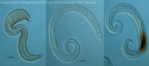 Figure 1. Microscopic images (magnification 1000x) of different morphologies of Nematoda. Size bars indicate 50µm. Copyright ©Marine Biology Research Group, Ghent University, Freija Hauquier