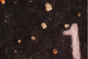Foraminifera pictures from a multinet sample