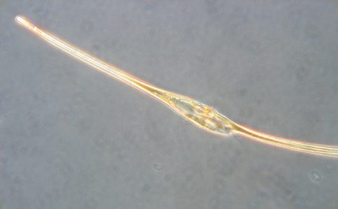 Dinoflagellaten der Art Ceratium fusus aus einem Netzfang in der Kieler Inneförde. Foto: A. Stuhr, GEOMAR