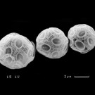 Drei Zellen der wichtigsten einzelligen Kalkalge der Weltozeane, Emiliania huxleyi. Foto: Kai T. Lohbeck, GEOMAR