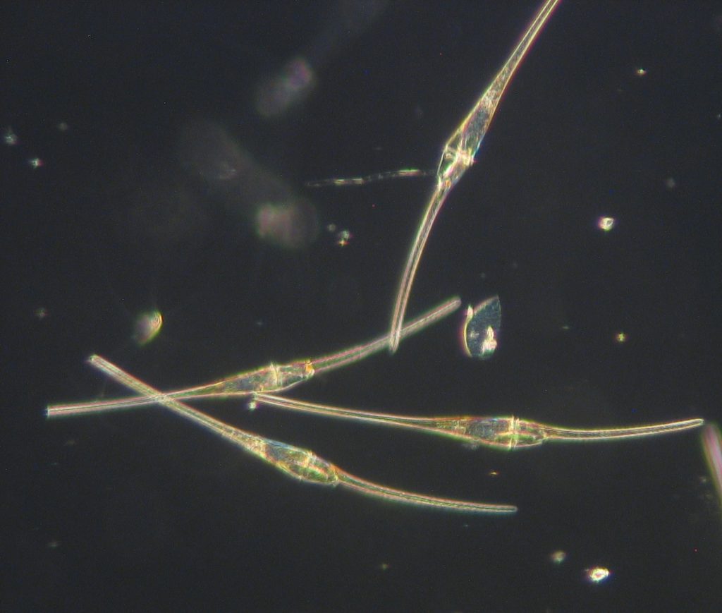 Dinoflagellaten der Art Ceratium fusus aus einem Netzfang in der Kieler Inneförde. Foto: A. Stuhr, GEOMAR