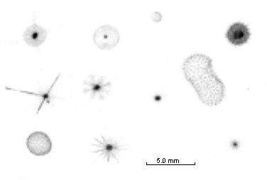 UVP Bilder verschiedener Rhizaria. / UVP images of different Rhizarians